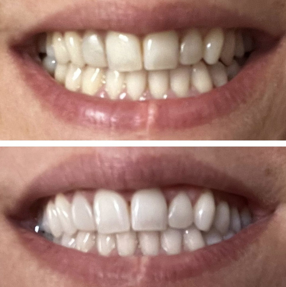 <h2>Real Results</h2>