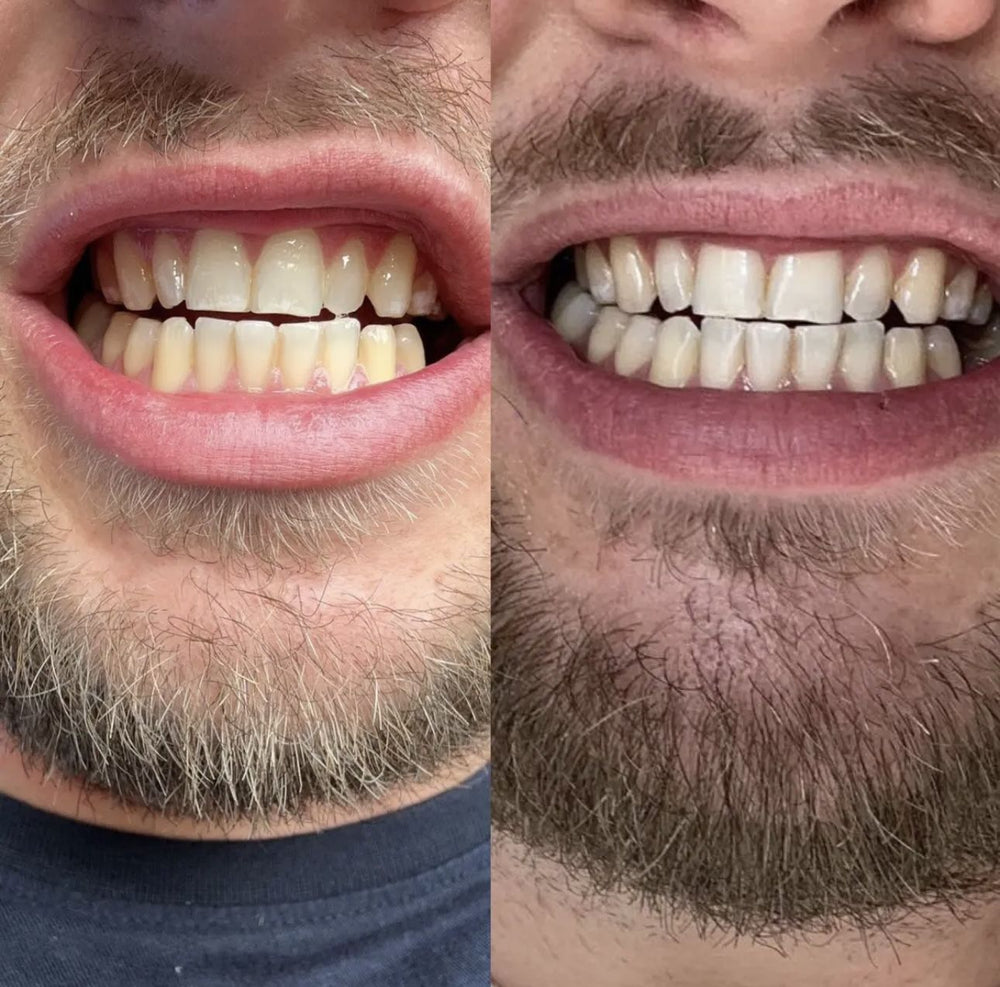 <h2>Real Results</h2>
