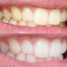 <h2>Real Results</h2>